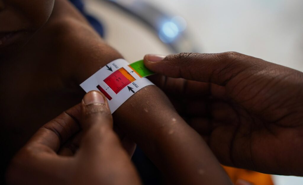 Nigeria: Govt Raises Alarm Over Nigeria's Triple Burden of Malnutrition