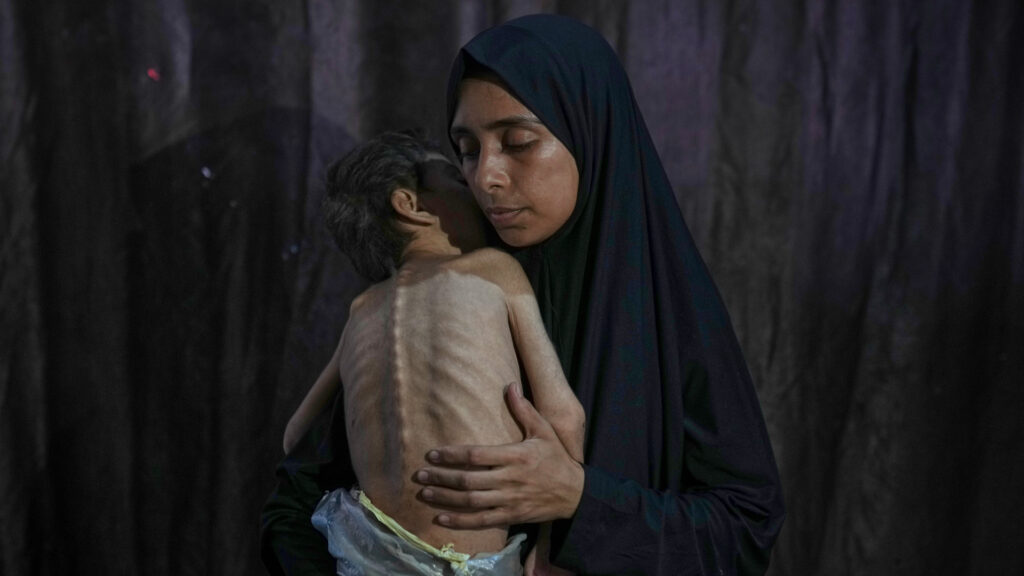 Where does Trump stand on Israel’s starvation of Palestinians? | Israel-Palestine conflict