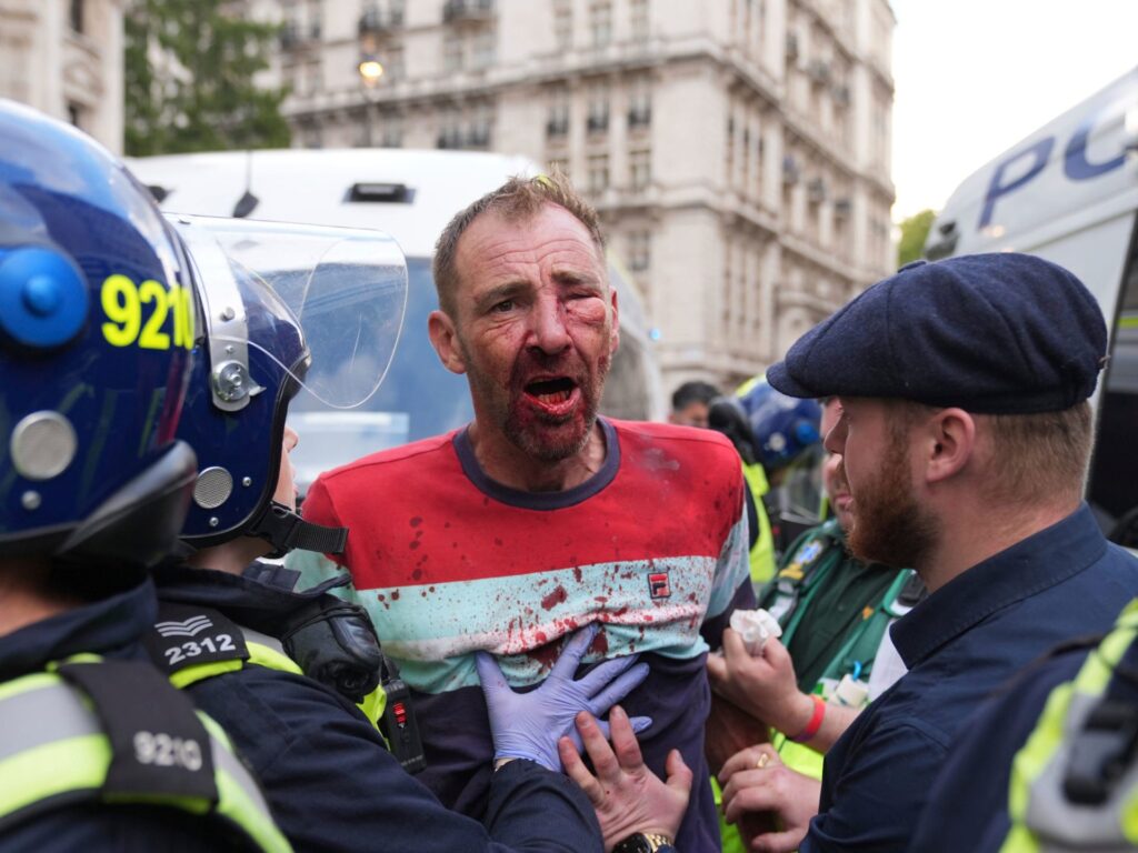 Clashes in London as 110,000 join far-right rally against immigration | Protests News