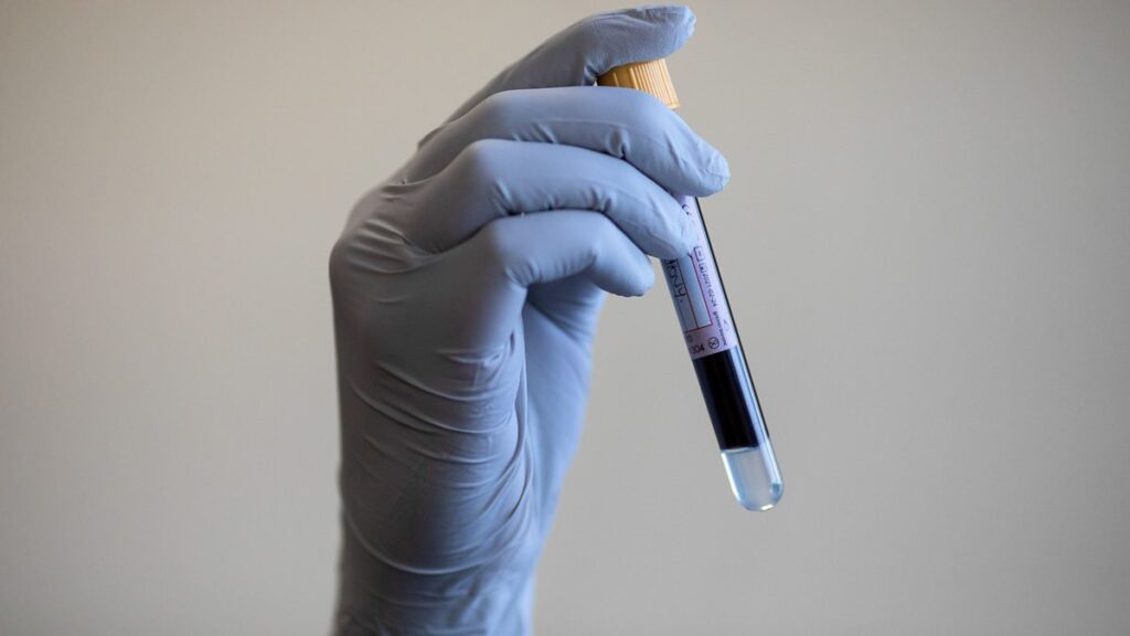 Error Leaves Diabetes Patients Needing New Tests