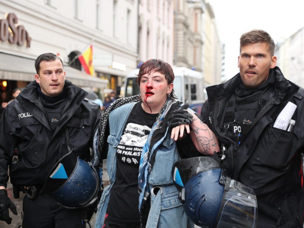 Ireland intervenes after Gaza activist national beaten by German police | Protests News