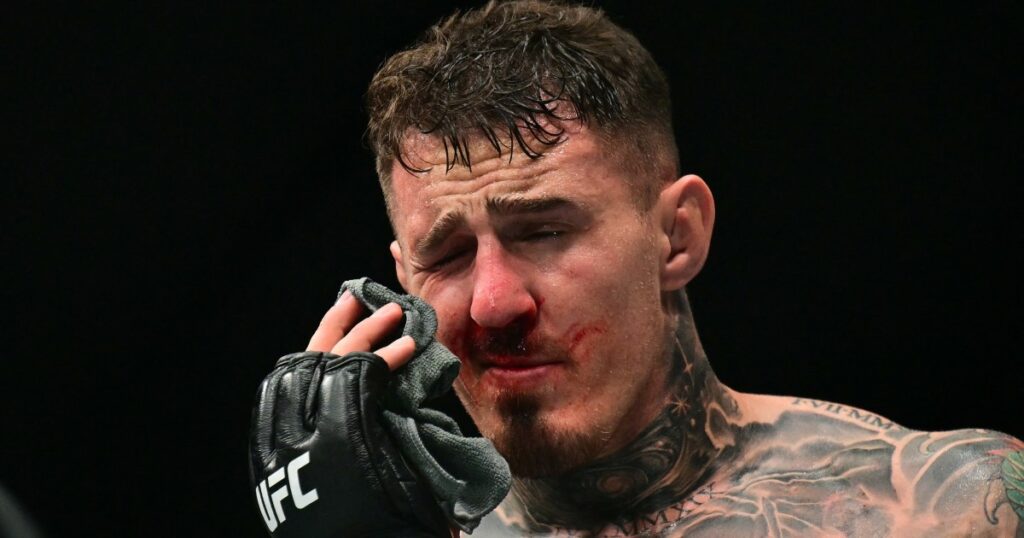 Aspinall-Gane UFC 321 title fight ruled no contest after eye poke | Mixed Martial Arts News Aspinall-Gane UFC 321 title fight ruled no contest after eye poke | Mixed Martial Arts News